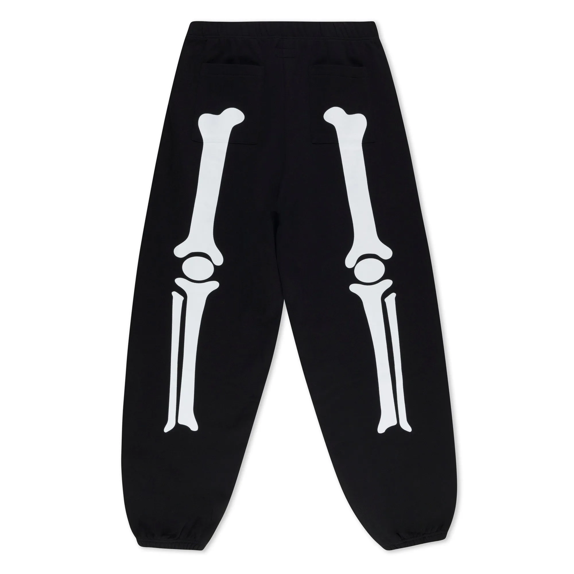 Skelly Nerm Sweatpants (Black)